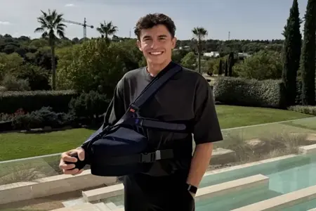 Marc Marquez Mengabarkan Tentang Kemajuan Cedera Bahunya